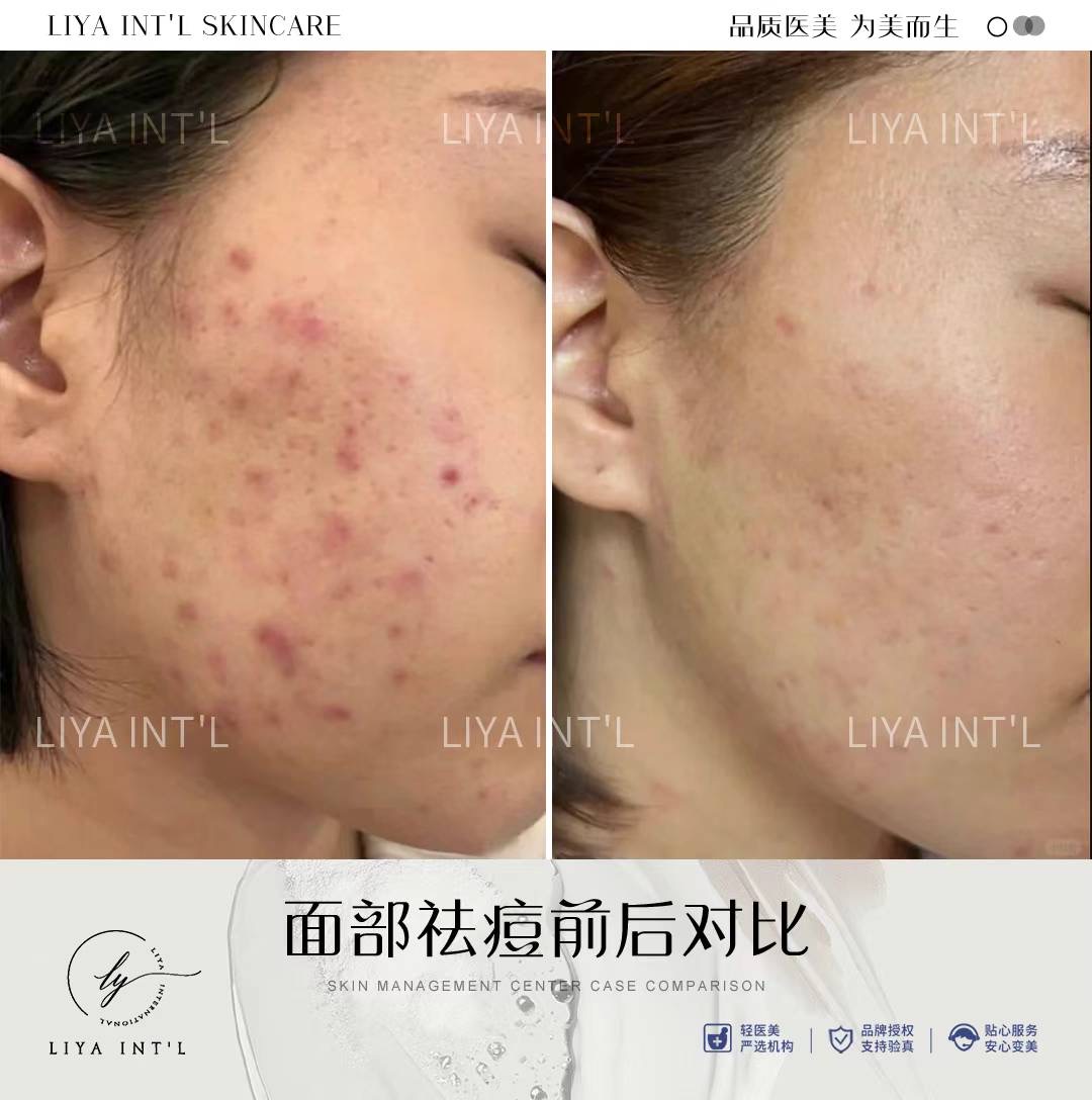 Liya Int'L Skincare gallery image