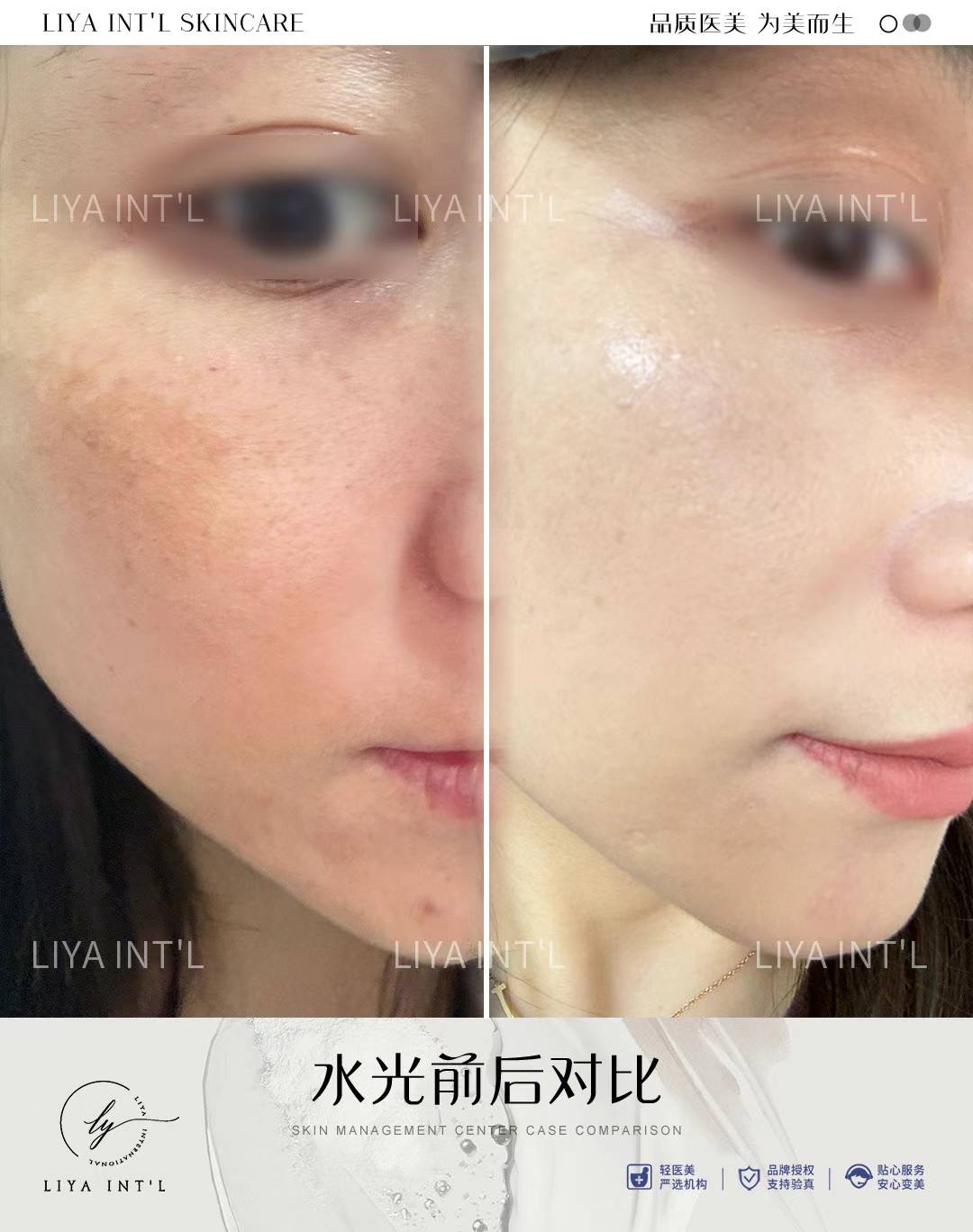 Liya Int'L Skincare gallery image