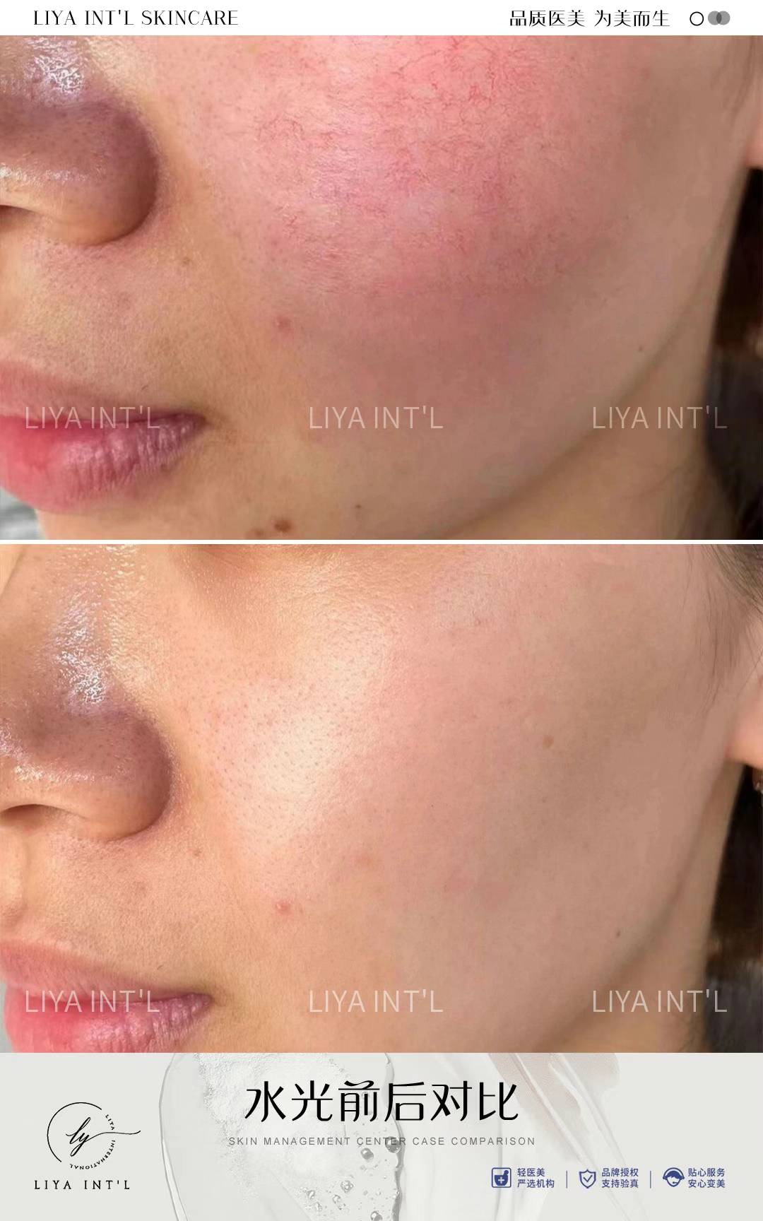 Liya Int'L Skincare gallery image