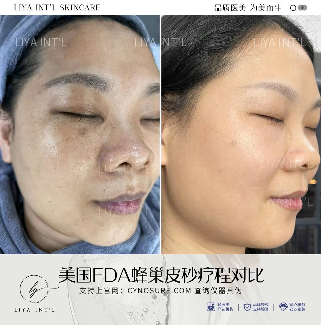 Liya Int'L Skincare gallery image